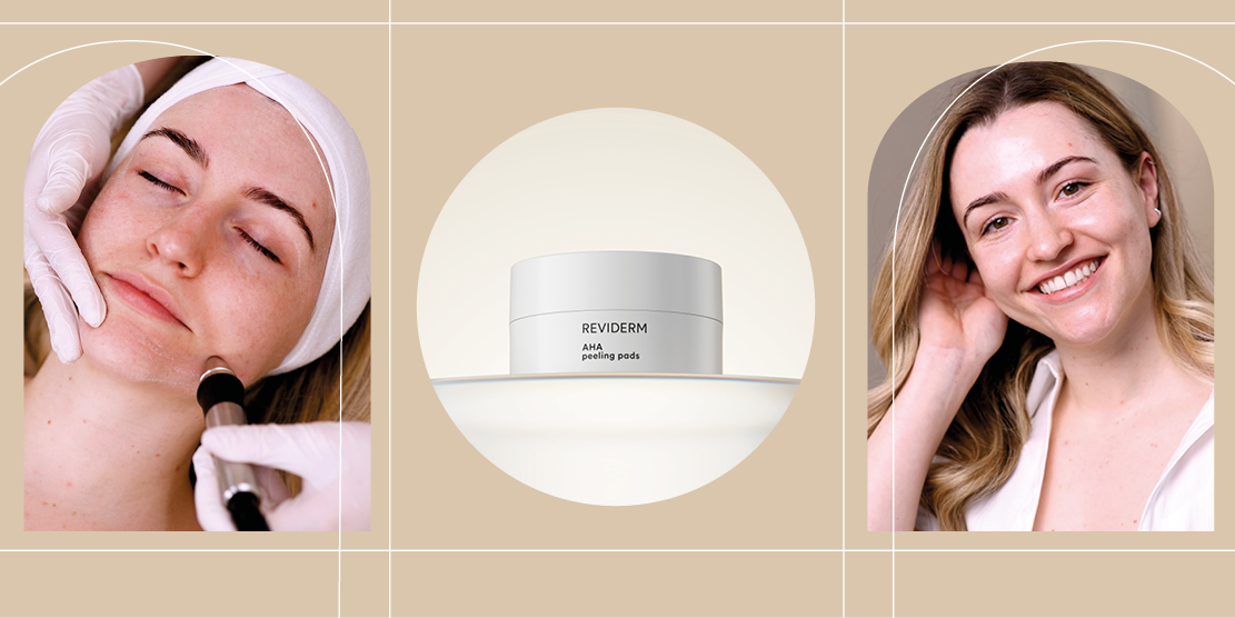 Behandlung des Monats Skin Renewal Treatment | Renew. Refine. Glow.